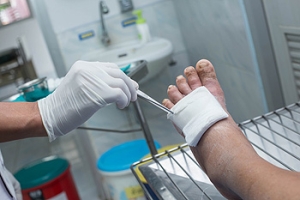 Dangers of Diabetic Foot Ulcers