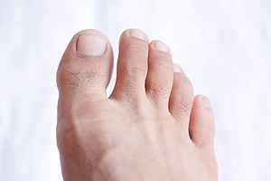 Why Does My Toe Hurt?