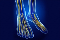 How Is Tarsal Tunnel Syndrome Diagnosed?