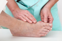 What Does a Bunion Look Like?