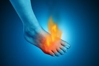 Causes of Burning Feet After a Run