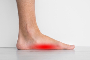 Living With Flat Feet