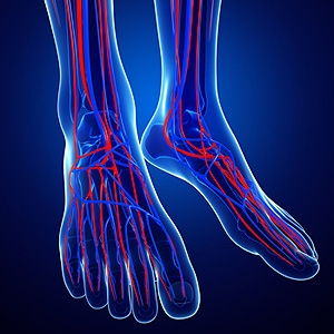 How to Deal with Varicose Veins