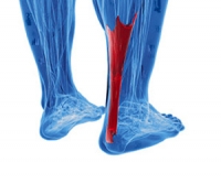What Is Causing My Achilles Tendon to Hurt?