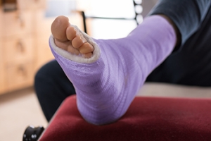 Dealing With Ankle Fractures