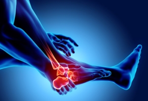 How Does Charcot Foot Happen?